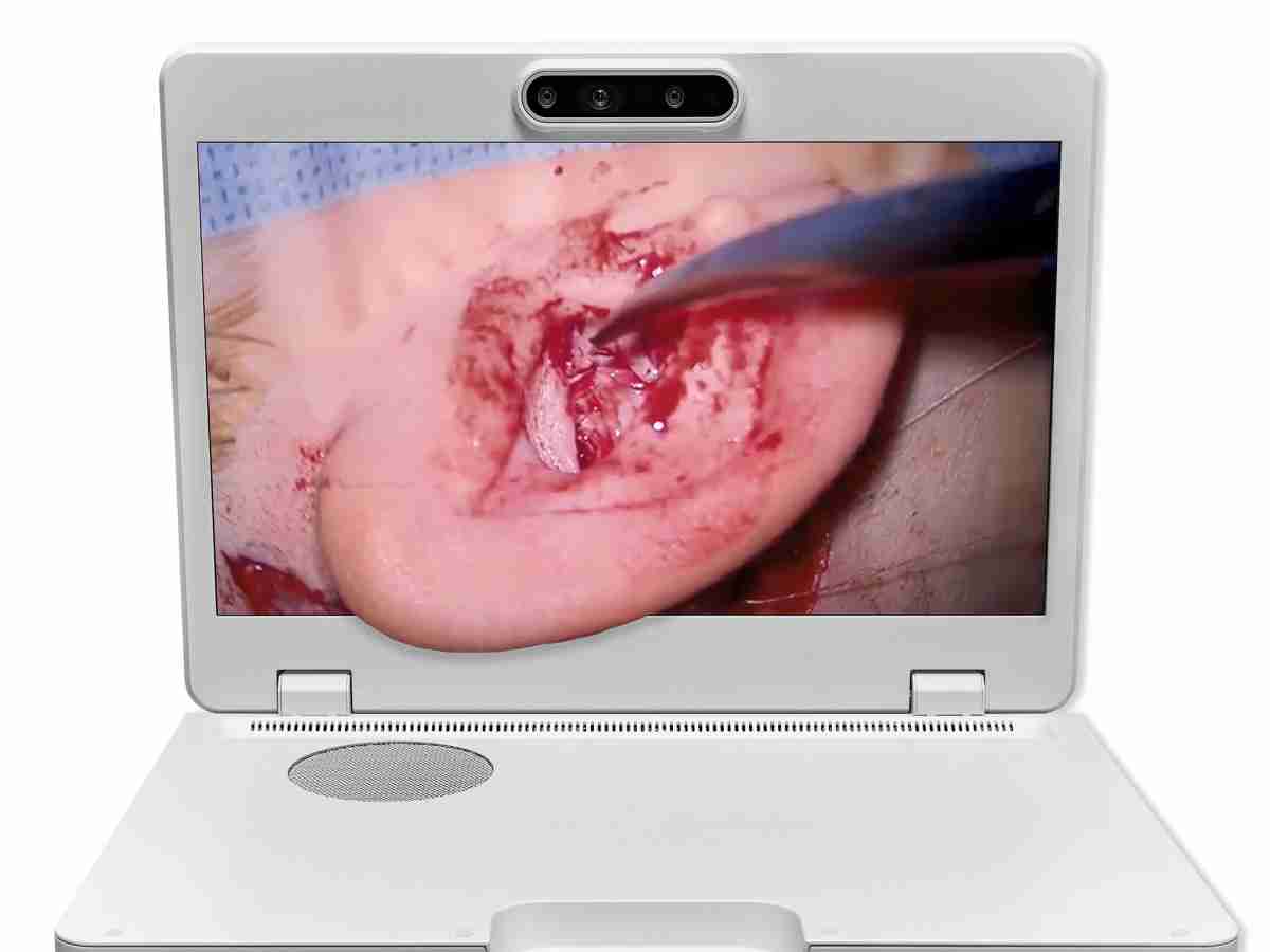 达擎之＂Heads-up 3D显微手术显示系统＂，，，，整合4K裸眼3D显示及眼球追踪系统，，，，具备快速追踪人眼移动位置功能，，减轻医师长时间维持固定姿势的负担，，，，让医师能有更宽广清晰的3D立体视野及更舒适的姿势来执行手术。。。。